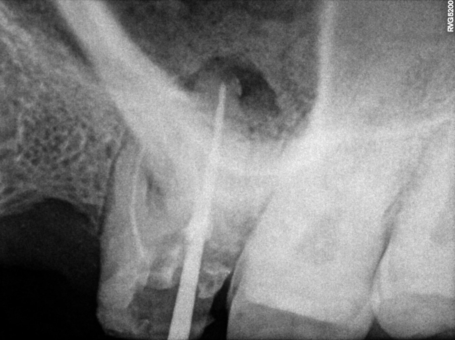 Dental X-ray